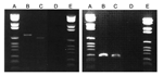 Thumbnail of Agarose gel stained with ethidium bromide showing the amplicons intergenic spacer (left panel) and pap31 (right panel) in cuspid teeth from 2 cats. Lanes A and E, DNA size ladder; lane B, cat 1; lane C, cat 2; lane D, negative control.