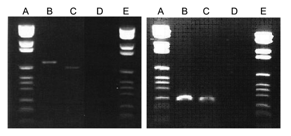 Agarose gel stained with ethidium bromide showing the amplicons intergenic spacer (left panel) and pap31 (right panel) in cuspid teeth from 2 cats. Lanes A and E, DNA size ladder; lane B, cat 1; lane C, cat 2; lane D, negative control.