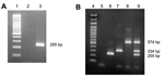 Thumbnail of Ethidium bromide stain of 2% agarose gel showing reverse transcription–polymerase chain reaction (RT-PCR) products of human coronaviruses (HCoVs). A) Simple 1-step RT-PCR (HCoV-NL63, gene N): lane 1, size markers (100 bp); lane 2, negative control RT-PCR mix; lane 3, positive control HCoV-NL63. B) Multiplex 1-step RT-PCR (HCoVs NL63, OC43, 229E): lane 4, size markers (100 bp); lane 5, negative control RT-PCR mix; lane 6, positive control HCoV-NL63; lane 7, positive control HCoV-OC43