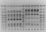 Thumbnail of Pulsed-field gel electrophoresis patterns of human and feline isolates from Minnesota outbreak,1999. Lanes 1, 2, 8, 14, and 15 contain Xbal-digested DNA from the standard strain H9812; lanes 3, 4, 9, and 10 contain human isolates; lanes 5–7, and 11–13 contain feline isolates. Lanes 3–7 were digested with Xbal and lanes 9–13 with Blnl.