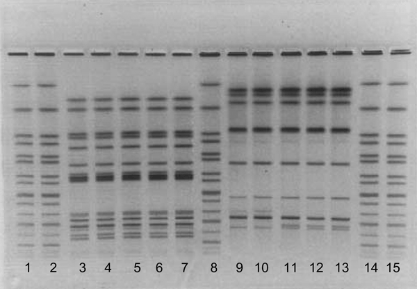 Pulsed-field gel electrophoresis patterns of human and feline isolates from Minnesota outbreak,1999. Lanes 1, 2, 8, 14, and 15 contain Xbal-digested DNA from the standard strain H9812; lanes 3, 4, 9, and 10 contain human isolates; lanes 5–7, and 11–13 contain feline isolates. Lanes 3–7 were digested with Xbal and lanes 9–13 with Blnl.