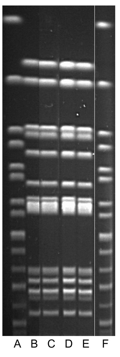 Pulsed-field gel electrophoresis patterns associated with the Washington state outbreaks, 1999 and 2000. Lanes A and F are standards; lane B is cat, clinic B; lane C is cat, clinic C; lanes D and E are human isolates.(For confidentiality reasons, Washington Department of Health did not identify which human isolates were from which outbreak.) Human and cat isolates are indistinguishable.