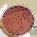 Thumbnail of Colonies of Chromobacterium violaceum on a chocolate agar plate.