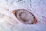 Thumbnail of Trichinella larvae in a sample of infected meat (light microscopy, ×100).