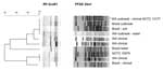 Thumbnail of Molecular typing results for Burkholderia pseudomallei isolates from Brazil compared with Western Australian and reference isolates. The Unweighted Pair Group Method using arithmetic averages dendrogram on the left refers to the EcoR1 ribotype patterns in the center. XbaI DNA macrorestriction (pulsed-field gel electrophoresis, PFGE) patterns are shown at the right of the corresponding ribotypes for comparison. The ribotypes and PFGE types are each numbered from the first lane at the