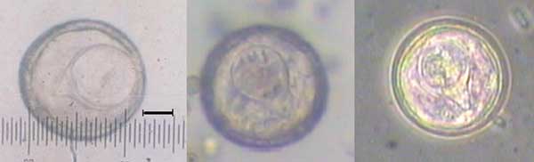 Eggs collected from proglottids. Left panel shows the length of the egg, scale bar = 10 μm; middle panel shows the hooklets in the egg; right panel shows the pyriform apparatus in the egg (under convert microscope).