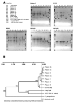 Thumbnail of Molecular typing of Aspergillus ustus isolates by using random amplification of polymorphic DNA. The isolate from patient 3 was not viable on subculturing and, as such, was not available for molecular analysis. Gel images (A) and composite dendrogram (B) are shown.