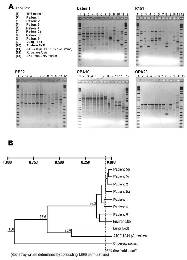 Molecular typing of Aspergillus ustus isolates by using random amplification of polymorphic DNA. The isolate from patient 3 was not viable on subculturing and, as such, was not available for molecular analysis. Gel images (A) and composite dendrogram (B) are shown.