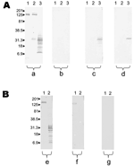 Thumbnail of Results of Western blot performed with serum samples from patient 5 with Rickettsia felis infection and patient 10 with R. typhi infection. Molecular masses (in kilodaltons) are given to the left of panels. A) Patient with R. felis infection; a, untreated serum analyzed by using R. conorii (lane 1), R. typhi (lane 2), and R. felis (lane 3); b, R. felis–adsorbed serum analyzed by using R. conorii (lane 1), R. typhi (lane 2), R. felis (lane 3); all antibodies were removed; c, R. typhi