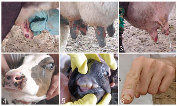 Lesions caused by Passatempo virus infection. Panels 1 and 2, ulcerative lesions on cows' teats; 3, mastitis caused by bacterial secondary infection; 4 and 5, lesion on calves' muzzle and oral mucosa; 6, lesions of dairy farm milker.