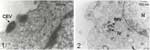 Thumbnail of Electron micrographs of cells infected with Passatempo virus. Vero cells were infected with Passatempo virus at a multiplicity of infection of 5 and fixed by OsO4, 24 hours after inoculation. 1, typical orthopoxvirus "brick-shaped" morphologic pattern, with biconcave core and outer membranes were observed in cell-associated enveloped virus (CEV); 2, intracelullar mature virions (IMV) were visualized in the cytoplasm of infected cells within virosomes with the presence of spheric imm