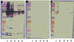 Thumbnail of Western blot and cross-adsorption results in a patient with Bartonella quintana endocarditis. A) Nonadsorbed. B) Adsorbed with B. quintana. C) Adsorbed with B. henselae. Lane 1, B. quintana; lane 2, B. henselae; lane 3, B. elizabethae; lane 4, B. vinsonii subsp. Berkhoffi; lane 5, B. vinsonii subsp. Arupensis. Before adsorption (A), antibodies are detected against all species (1, 2, 3, 4, and 5). After adsorption with B. quintana antigen (B), all antibodies disappear. After adsorpti