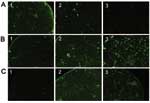 Thumbnail of Pictures of immunofluorescence assay performed on serum specimens with proven Rickettsia conorii (A), R. felis (B), or R. typhi (C) infection showing cross-reactive antibodies. Antigens tested were R. conorii (column 1), R. felis (column 2), and R. typhi (column 3). The serum with R. conorii infection reacts with R. conorii and R. felis antigens but not with R. typhi (A). Conversely, the serum with R. typhi infection reacts with R. typhi and R. felis but not with R. conorii (C). Fin