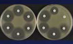 Thumbnail of Disk susceptibility test results of Escherichia coli BM694 (left) and of strain BM694 harboring plasmid pAT346, which confers tobramycin resistance by trapping (right) (27).