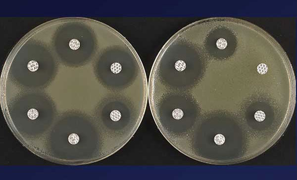Disk susceptibility test results of Escherichia coli BM694 (left) and of strain BM694 harboring plasmid pAT346, which confers tobramycin resistance by trapping (right) (27).