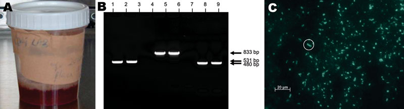 A) Grossly bloody sputum sample obtained from the surviving patient (caregiver B2) 30 h after onset of primary pneumonic plague. B) Polymerase chain reaction results of sputum sample from caregiver B2. Lanes 1–3, caf1; lanes 4–6, repA1; lanes 7–9, pla. Lanes 1, 4, and 7 are positive controls; lanes 2, 5, and 8 are patient samples; lanes 3, 6, and 9 are negative controls. C) Anti-F1 direct fluorescent antibody staining of sputum sample from caregiver B2. Numerous bacteria with classic halo struct