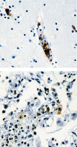Thumbnail of Immunohistochemical stain shows spotted fever group rickettsia in endothelial cells of a blood vessel in brain (top panel) and lung (bottom panel).