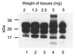Thumbnail of Immunoblot for protease-resistant prion protein (PrPres) from tissues of SJL/OlaHsd mouse infected with human variant Creutzfeld-Jakob disease (vCJD). Lanes 1–5 show representative pattern of extracted PrPres after digestion with proteinase K (100 μg/mL). Lane 1, brain tissue of vCJD patient (World Health Organization reference sample). Lanes 2–5, samples from vCJD mouse in which spontaneous lymphoreticular system tumors developed: lane 2, brain; lane 3, spleen with nodular tumors; 
