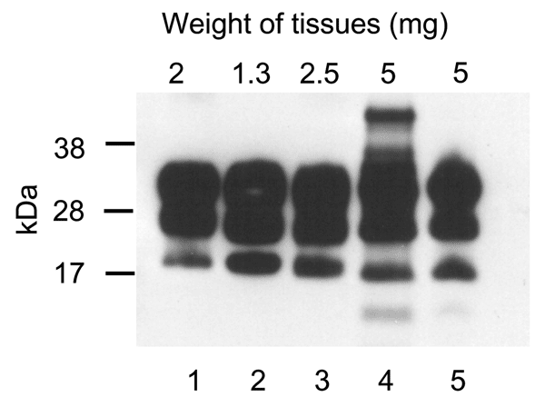 Immunoblot for protease-resistant prion protein (PrPres) from tissues of SJL/OlaHsd mouse infected with human variant Creutzfeld-Jakob disease (vCJD). Lanes 1–5 show representative pattern of extracted PrPres after digestion with proteinase K (100 μg/mL). Lane 1, brain tissue of vCJD patient (World Health Organization reference sample). Lanes 2–5, samples from vCJD mouse in which spontaneous lymphoreticular system tumors developed: lane 2, brain; lane 3, spleen with nodular tumors; lane 4, tissu