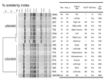 Thumbnail of Pulsed-field gel electrophoresis (PFGE)–based dendrogram of methicillin-resistant Staphylococcus aureus strains isolated during the outbreak. A genetic similarity index scale is shown above the dendrogram. Strain numbers, clone identification, site of infection, and demographic information are included along each PFGE lane. MLST, multilocus sequence typing; SCCmec, staphylococcal cassette chromosome mec; NA, not available; ND, not determined.