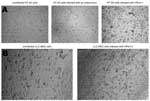 Thumbnail of Cytopathic effects (CPEs) observed 3 days after infection of HT-29 cells with an enterovirus or a human parechovirus (HPeV)-1 isolate after 1 passage on this cell line (A); CPE observed 1 day after infection of LLC-MK2 cells with a HPeV-3 isolate after 3 passages on this cell line (B).