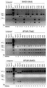 Thumbnail of Polymerase chain reaction–restriction fragment length polymorphism (PCR-RFLP) analyses of clinical isolates from Brazil compared to analyses of clonal strains. Shown are the PCR markers SAG3 and BTUB, with their respective restriction digests. Alleles are designated below each figure panel and match those given in the Table. Agarose gel electrophoresis of undigested and restriction digested products for type stained (type I RH, type II Me49, type III CTG). Products were resolved on 