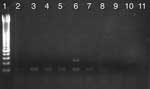 Thumbnail of PCR amplification of a 120-bp fragment of kinetoplastid mitochondrial DNA of Leishmania spp. in Egyptian and Nubian mummies. Lane 1, 50-bp ladder lanes 2–8, mummy samples; lanes 9,10, extraction controls; lane 11, PCR controls. Lane 6 provides a positive amplification product of the expected size.