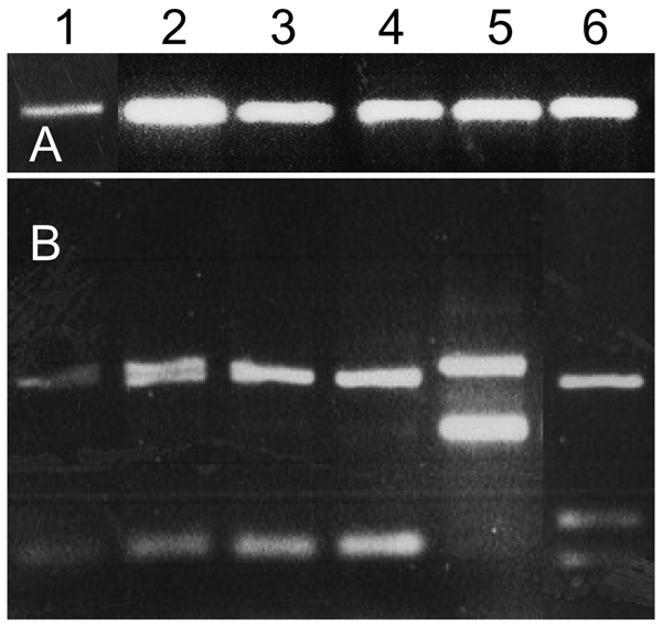 A) PCR of Leishmania internal transcribed spacer region 1 (ITS1) of naturally infected Phlebotomus sergenti sand flies and cultured Leishmania spp. controls. B) HaeIII digestion of restriction fragment length polymorphisms of ITS1 PCR products shown in A. Lane 1, P. sergenti female 1; lane 2, P. sergenti female 2; lane 3, P. sergenti female 3; lane 4, L. tropica (Lt-L590); lane 5, L. major (Lm-L777); lane 6, L. infantum (Li-L699).
