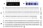 Thumbnail of Molecular evidence for Borrelia infection. A) PCR for fla gene from Borrelia burgdorferi sensu lato; B) Southern blot assay with probes specific for B. burgdorferi sensu stricto; C) Sequences of fla gene amplified from 2 patients with erythema migrans (lines 1 and 2) and 1 with lymphocytoma (line 3) and aligned with the sequence of the fla gene from B. burgdorferi sensu stricto strain B31;and D) Sequence of the osp A gene amplified from a patient with erythema migrans (line 1) and aligned with the ospA gene from B. burgdorferi sensu stricto strain B31.