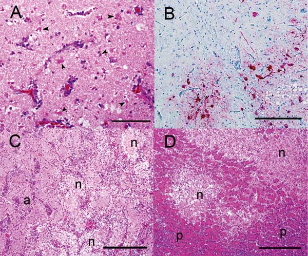 Photomicrographs of visceral organs from a wood duck that died after intranasal inoculation with a highly pathogenic avian influenza H5N1 virus. A) Brain with severe, multifocal to coalescing neuronal necrosis. Note the numerous necrotic neurons (arrowheads). Hematoxylin and eosin (HE) stain; bar =100 μm. B) Brain. Note the viral antigen (red) detected in the nucleus of several neurons. The unaffected brain tissue is blue. Immunohistochemical stain with hematoxylin counterstain; bar = 200 μm. C)