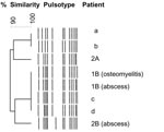Thumbnail of Dendogram constructed from the schematic representation of the pulsed-field gel electrophoresis types of 4 epidemic methicillin-susceptible Staphylococcus aureus (MSSA) isolates included in this study (patients 2A, 1B, and 2B); 1 strain subsequently isolated from an abscess in a soldier belonging to company A, who had been in Côte d’Ivoire in October 2005 (patient b); and 3 MSSA strains isolated from abscesses in soldiers belonging to a company other than A or B (patients a, c, d).