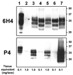 Thumbnail of Molecular analyses of the zebu under investigation. Western immunoblot with monoclonal antibodies (MAbs) 6H4 (upper panel) and P4 (lower panel) after limited proteinase K digestion (100 μg/mL, 40 min, 48°C) of 10% brainstem (lanes 3 and 4) and thalamus (lanes 5, 6, and 7) tissue homogenates of the zebu (lanes 3 and 5), a cow with bovine spongiform encephalopathy (lanes 4 and 6), and a sheep with scrapie (lane 7). An undigested cattle brainstem tissue homogenate (lane 1) and a cerebr