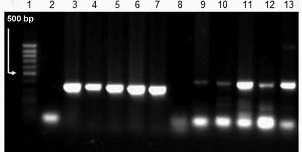 Results of herpes simplex virus (HSV) type 1 and type 2 PCRs in postmortem specimens. Lane 1, 100-bp DNA ladder; lane 2, negative control HSV-1; lane 3, positive control HSV-1; lane 4, tracheal aspirate HSV-1; lane 5, liver HSV-1; lane 6, lung HSV-1; lane 7, stomach HSV-1; lane 8, negative control HSV-2; lane 9, positive control HSV-2; lane 10, tracheal aspirate HSV-2; lane 11, liver HSV-2; lane 12, lung HSV-2; lane 13, stomach HSV-2.