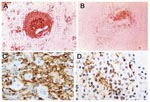 Thumbnail of Immunohistochemical identification of B cells and follicular dendritic cells in spleens of patients dying of trauma or sepsis. Total B cells are decreased in the spleen of a patient with sepsis (B) compared with that of a trauma patient (A) (magnification ×400). Similarly, follicular dendritic cells are decreased in the spleen of a patient with sepsis (D) compared with that of a trauma patient (C) (magnification ×600).