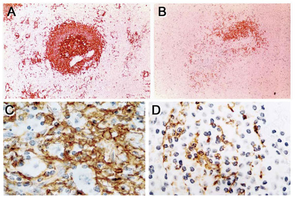 Immunohistochemical identification of B cells and follicular dendritic cells in spleens of patients dying of trauma or sepsis. Total B cells are decreased in the spleen of a patient with sepsis (B) compared with that of a trauma patient (A) (magnification ×400). Similarly, follicular dendritic cells are decreased in the spleen of a patient with sepsis (D) compared with that of a trauma patient (C) (magnification ×600).
