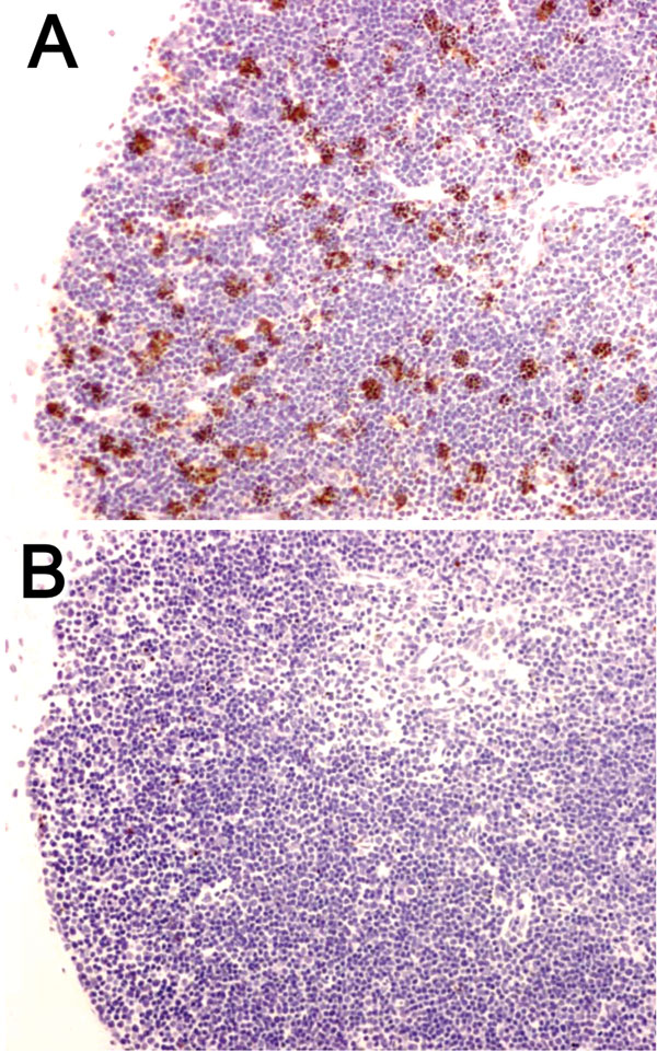 Decreased apoptosis caused by overexpression of Bcl-2 protein in a mouse model of plague. Wild-type mice (A) and mice that overexpressed Bcl-2 in lymphocytes (B) were injected intranasally with Yersinia pestis. Thymuses were obtained at 72 h postinfection and stained by using the terminal deoxynucleotidyl method as a marker of apoptotic cell death. Note the decrease in apoptotic cells in the thymus of the Bcl-2 transgenic mouse (magnification ×400).