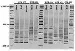 Thumbnail of Comparison of PCR ribotypes of Clostridium difficile isolates from meat and of human, bovine, and canine origin in Ontario, Canada, 2005, by using the method of Bidet et al (10). PCR 077, 014, and 027 represent international ribotype nomenclature recently reported for calves (4). PCR M26 and M31 are temporary ribotype designations. Note that PCR M31 and 027, both NAP1/toxinotype III ribotypes, are different.