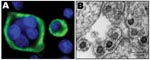 Thumbnail of Immunofluorescence and electron microscopy results. A) Typical multinucleated giant cells with a clear seroreactivity of AG16 antigens, determined by using an immunofluorescence assay with positive anti–foamy virus serum, on BHK-21–infected cells cocultivated with stimulated peripheral blood mononuclear cells. B) Electron microscopy of ultrathin sections from cells infected by AG16 foamy virus.