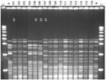 Thumbnail of Pulsed-field gel electrophoresis (PFGE) analysis of chromosomal DNA from pharyngeal meningococcus isolates (stained with ethidium bromide). Whole chromosome DNA macrorestriction fragments were generated by digestion with endonuclease SpeI. Shown are examples of sequence type (ST) prediction by PFGE in carried meningococci and diversity among STs. S, isolates tested by multilocus sequence typing (MLST). Lanes λ (arrows), PFGE marker I (Boehringer Mannheim, Mannheim, Germany); lane A, ST-2881, meningitis case isolate, Niger 2003; lanes 101, 102, and 103, ST-11, W135:2a:P1.5,2; lanes 104 and 105, ST-2881, W135:NT:P1.5,2; lane 106, ST-4151, W135:NT:P1.5,2; lane 107, ST-112000, W135:NT:P1.5,2; lanes 108–116, ST-11, W135:2a:P1.5,2; lane B, meningitis case isolate, ST-11, Niger 2003. Isolates 101 and 107 were identified as ST-11 by MLST. Isolates 102, 103, 108, 109, and 111–116 are indistinguishable from isolate 101 and are therefore considered ST-11. The 19 ST-11 isolates had 4 different PFGE patterns, of which 3 are represented by isolates 101, 107, and 110. The pattern of isolate 107 is indistinguishable from the 2000 Hajj epidemic strain (not shown).