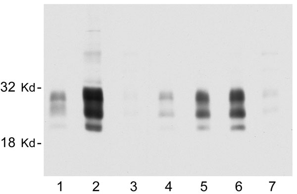 Representative immunoblot showing the relative amount of disease-associated prion protein (PrPres) in brain, tonsil, and selected lymph nodes from a single chronic wasting disease (CWD)–affected mule deer. All lanes were loaded with 10-mg equivalents of tissue (original wet weight basis). Lane 1, brain; lane 2, tonsil; lane 3, popliteal lymph node; lane 4, retropharyngeal lymph node (RPLN); lane 5, prescapular lymph node; lane 6, submandibular lymph node; lane 7, mesenteric lymph node. PrPres bands were visualized by using antibody L42 at 0.04 μg/mL and standard enhanced chemiluminescence processing.