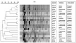 Thumbnail of Pulsed-field gel electrophoresis of bacteremic Klebsiella pneumoniae isolates of serotype K1.