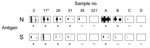 Thumbnail of Results of Western blot analysis with recombinant severe acute respiratory syndrome–associated coronavirus (SARS-CoV) nucleocapsid (N) and spike (S) protein. Shown are examples for SARS-CoV ELISA–positive (2, 17, 26, 31) and –negative (38, 321) bat serum specimens tested using full-length recombinant SARS-CoV N and a fragment of the S protein (amino acids 318–510). Serum specimens were diluted 1:2,500 (left strips) and 1:5,000 (right strips). Secondary detection was performed by incubating the nitrocellulose strips with horseradish peroxidase (HRP)–labeled goat-antibat immunoglobulin (Ig) (Bethyl, Montgomery, AL, USA) (1:10,000). For chemiluminescence, SuperSignal Dura substrate (Pierce, Rockford, IL, USA) was added and films exposed for 1 min. Serum 17* was used as a reference for comparing blots. For evaluation purposes, strips were also incubated with human SARS-CoV–positive (A, B) and –negative serum specimens C and D (HCoV-NL63 positive) at the same dilutions, using goat-antihuman Ig HRP (1:20,000) for secondary detection. Serum specimens that produced signals at a dilution of 1:5,000 were recorded as positive (+).