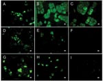 Thumbnail of Results of indirect immunofluorescence (IF) test with Vero E6 cells infected with severe acute respiratory syndrome–associated coronavirus (SARS-CoV). The SARS-CoV diagnostic IIFT kit (EUROIMMUN AG, Lübeck, Germany) was used with minor modifications: bat and reference human serum specimens were diluted 1:100 (found to be the optimal dilution for bat sera) in sample buffer, and secondary detection was performed with goat-antibat immunoglobulin (Ig) (Bethyl, Montgomery, AL, USA) followed by fluorescein isothiocyanate (FITC)–labeled donkey-antigoat Ig (Dianova, Hamburg, Germany) (A–F) or FITC-labeled goat-antihuman Ig (G–I). Frames A–D, SARS-CoV ELISA–positive bat serum specimens 2, 17, 26, 31; E–F, ELISA-negative bat serum specimens 38 (showing unspecific signals) and 306; G–H, SARS-CoV–positive human control serum specimens A and B; I, negative human serum C. All photographs were taken at equivalent microscope settings. Scale bars represent 20 μm.