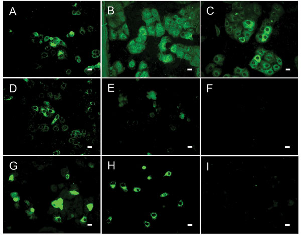 Results of indirect immunofluorescence (IF) test with Vero E6 cells infected with severe acute respiratory syndrome–associated coronavirus (SARS-CoV). The SARS-CoV diagnostic IIFT kit (EUROIMMUN AG, Lübeck, Germany) was used with minor modifications: bat and reference human serum specimens were diluted 1:100 (found to be the optimal dilution for bat sera) in sample buffer, and secondary detection was performed with goat-antibat immunoglobulin (Ig) (Bethyl, Montgomery, AL, USA) followed by fluorescein isothiocyanate (FITC)–labeled donkey-antigoat Ig (Dianova, Hamburg, Germany) (A–F) or FITC-labeled goat-antihuman Ig (G–I). Frames A–D, SARS-CoV ELISA–positive bat serum specimens 2, 17, 26, 31; E–F, ELISA-negative bat serum specimens 38 (showing unspecific signals) and 306; G–H, SARS-CoV–positive human control serum specimens A and B; I, negative human serum C. All photographs were taken at equivalent microscope settings. Scale bars represent 20 μm.