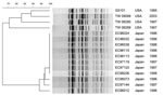 Thumbnail of Pulsed-field gel electrophoresis of XbaI-digested DNA from GUD+ O157:H7 strains. Strain designation, source and year of isolation are shown at right. This unweighted pair-group method with arithmetic mean dendrogram was generated in BioNumerics software (Applied Maths, St-Martens-Latem, Belgium) by using Die coefficient with a 1.0% lane optimization and 1.0% band position tolerance. The scale above the dendrogram indicates percent similarity.