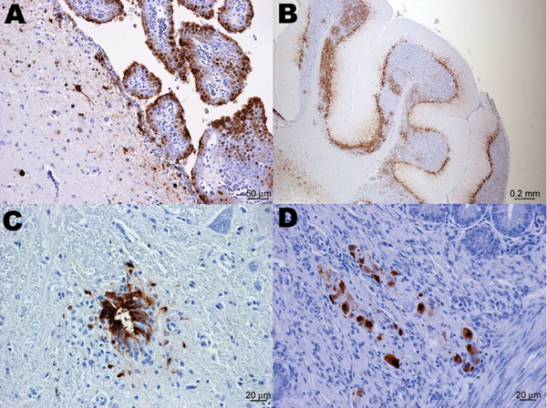Immunohistochemical staining for influenza virus nucleoprotein in central and peripheral nervous system of naive juvenile Canada geese tissues after challenge with influenza virus (H5N1). A) Cerebrum. Positive immunolabeling of neurons, glial cells, ependymal and choroid plexus epithelial cells. B) Cerebellum. Extensive positive immunolabeling of Purkinje cells and neurons of the granular layer. C) Spinal cord. Positive immunolabeling of ependymal cells of the central canal and adjacent neurons and glial cells. D) Small intestine. Positive immunolabeling of neurons of the submucosal plexus.