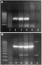 Thumbnail of Agarose gel electrophoresis of PCR products from Rhinosporidium seeberi–specific primers (A) and β-actin primers (B). The left lane contains a 100-bp ladder. Samples 1–4, from horses with histologic diagnoses of rhinosporidiosis; sample 5, from the skin of a noninfected horse; sample 6, negative control (water).