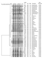Thumbnail of Dendogram of cluster analysis of pulsed-field gel electrophoresis (PFGE) banding patterns of XbaI-digested Salmonella enterica serotype Typhimurium DNA. A, ampicillin; C, chloramphenicol; K, kanamycin; Sxt, trimethoprim-sulfa; S, streptomycin; T, tetracycline; Su, sulfonamine; Caz, ceftazidime. TYP004 is the PFGE type characteristic of DT104. Each isolate represented here is a unique bovine-origin isolates (each is from a different herd, year, and resistance type). WA, Washington; ID, Idaho.