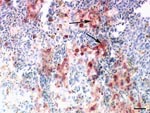 Thumbnail of Immunohistochemical demonstration of influenza A virus antigen (red, see arrows) in numerous splenic macrophages of a falcon after challenge with 106.0 50% egg infectious doses of the highly pathogenic avian influenza strain A/Cygnus cygnus/Germany/R65/06 (H5N1). Avidin-biotin-peroxidase complex method. Bar = 25 μm.