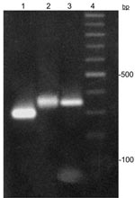 Thumbnail of Trypanosoma cruzi miniexon gene typing assay. Lanes 1 and 2, T. cruzi II (300 bp) and T. cruzi I (350 bp) markers, respectively; lane 3, T. cruzi I cloned fragment recovered from Brazilian mummy; lane 4, 100-bp ladder.